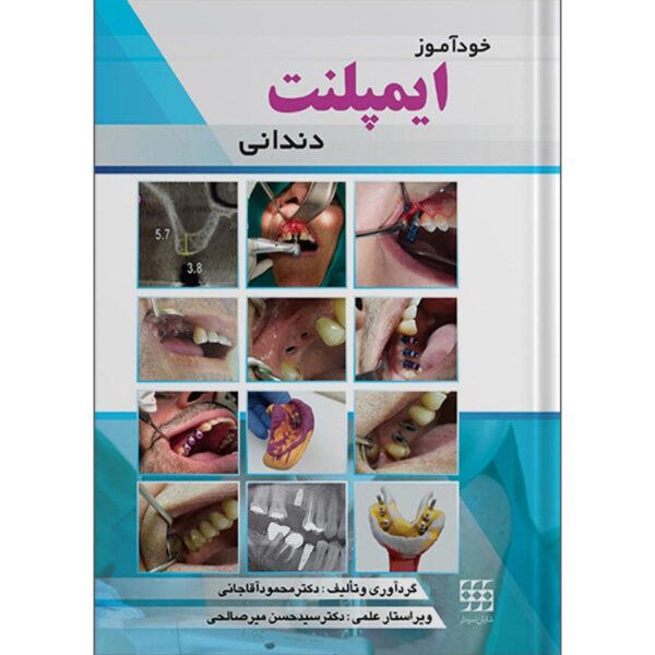 کتاب خودآموز ایمپلنت دندانی